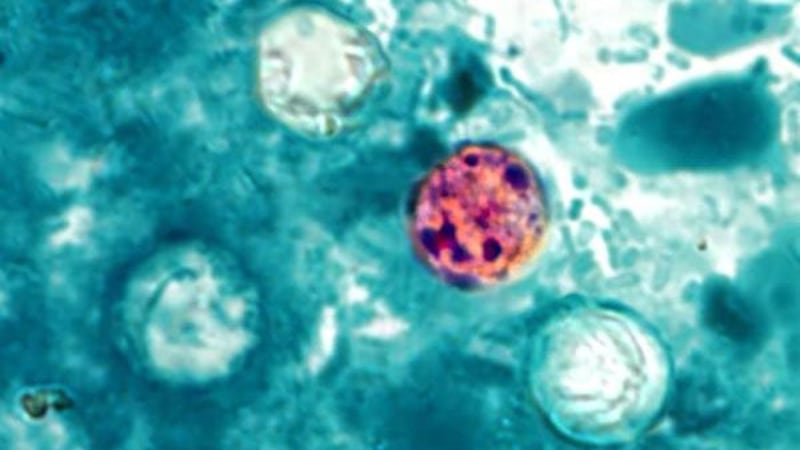 Stomach bug cases increase